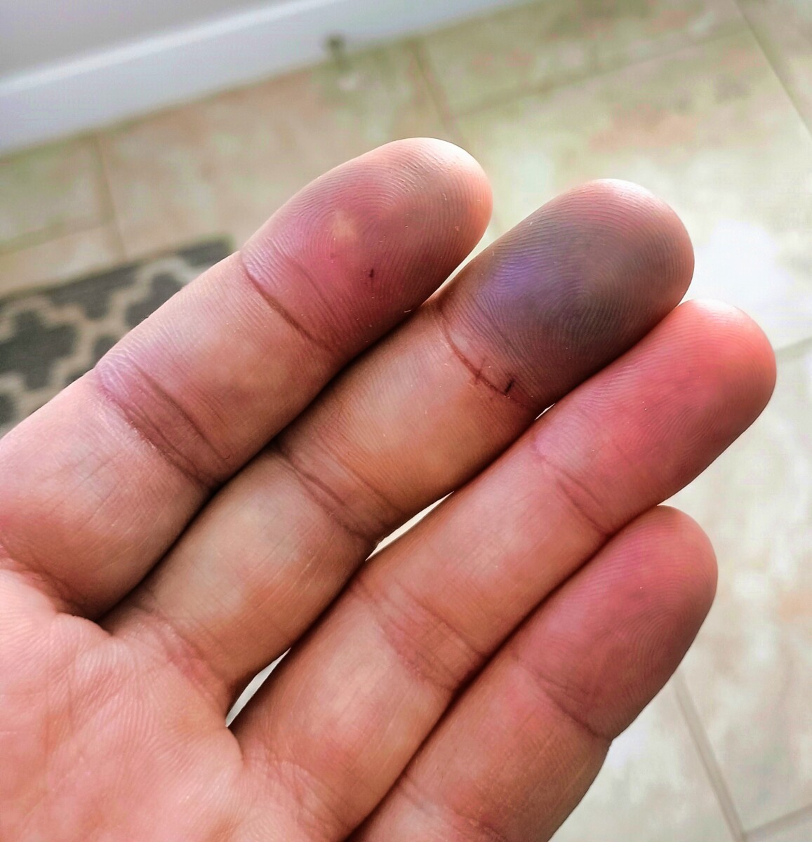 img_20251204_114717147_ae